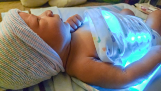 neonato con ittero