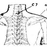 vertebra cervicale c7