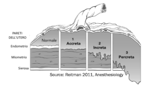 placenta