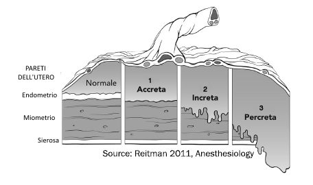 placenta